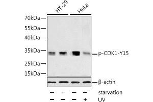 Western blot analysis of extracts of HT-29 and HeLa cells, using Phospho-CDK1-Y15 antibody (ABIN3019442, ABIN3019443, ABIN3019444 and ABIN6225371) at 1:1000 dilution. (CDK1 Antikörper  (pTyr15))