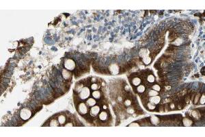 ABIN6267297 at 1/100 staining Mouse intestine tissue by IHC-P. (ATP1A1 Antikörper  (pSer16))
