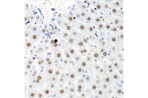 Immunohistochemistry of paraffin-embedded rat liver using PTBP1 antibody (ABIN5995415) at dilution of 1/100 (40x lens). (PTBP1 Antikörper)