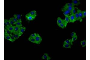 Immunofluorescence staining of HepG2 cells with ABIN7153351 at 1:133, counter-stained with DAPI. (GPR52 Antikörper  (AA 225-265))