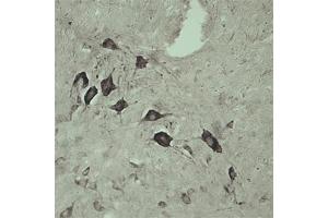 IHC on rat spinal cord using Rabbit antibody to internal part of Vacuolar protein sorting-associated protein 45 (rvps45, Vps45, Vps45a): IgG (ABIN351329) at a concentration of 10 µg/ml. (VPS45 Antikörper)