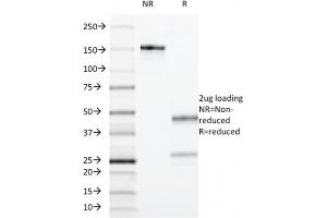 SDS-PAGE Analysis Purified CD55 Mouse Monoclonal Antibody (F4-29D9) . (CD55 Antikörper)