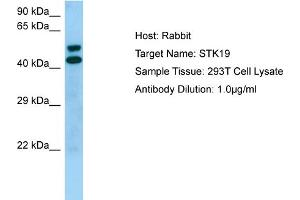 Western Blotting (WB) image for anti-serine/threonine Kinase 19 (STK19) (Middle Region) antibody (ABIN2774428) (STK19 Antikörper  (Middle Region))