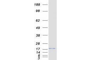 Western Blotting (WB) image for Vesicle-Associated Membrane Protein 4 (VAMP4) protein (Myc-DYKDDDDK Tag) (ABIN2735164)