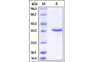 Human Carbonic Anhydrase IX (138-414), His Tag on SDS-PAGE under reducing (R) condition.