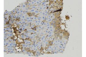 ABIN6274923 at 1/100 staining Mouse liver tissue by IHC-P. (BRP44L Antikörper  (Internal Region))