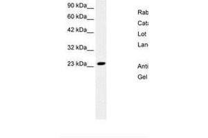 Image no. 2 for anti-MYST/Esa1-Associated Factor 6 (MEAF6) (N-Term) antibody (ABIN6736265) (MEAF6 Antikörper  (N-Term))