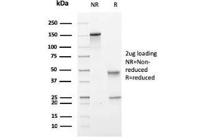 SDS-PAGE Analysis Purified PMEPA1 Mouse Monoclonal Antibody (PMEPA1/2697). (PMEPA1 Antikörper)