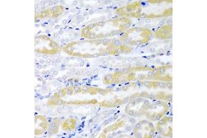 Immunohistochemistry of paraffin-embedded mouse kidney using FABP6 antibody at dilution of 1:200 (40x lens). (FABP6 Antikörper)