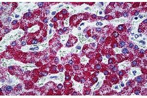 Human Liver: Formalin-Fixed, Paraffin-Embedded (FFPE) (CPS1 Antikörper  (AA 1400-1501))