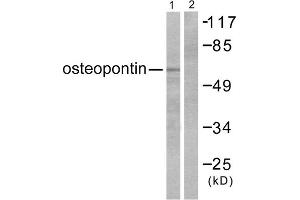 Western blot analysis of extracts from LOVO cells, using osteopontin antibody (ABIN5976474). (Osteopontin Antikörper  (C-Term))