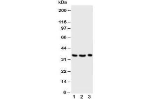 Western blot testing of Granzyme A antibody and Lane 1:  Jurkat;  2: CEM;  3: Raji cell lysate (GZMA Antikörper  (Middle Region))