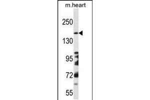 Western blot analysis in mouse heart tissue lysates (35ug/lane). (DCC Antikörper  (AA 643-670))
