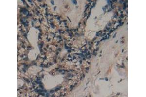 Used in DAB staining on fromalin fixed paraffin- embedded Kidney tissue (ADAMTS10 Antikörper  (AA 239-602))