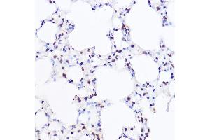 Immunohistochemistry of paraffin-embedded mouse lung using [KO Validated] BRG1/BRG1/SM Rabbit pAb (ABIN3022958, ABIN3022959, ABIN3022960 and ABIN6219317) at dilution of 1:100 (40x lens). (SMARCA4 Antikörper  (AA 30-130))