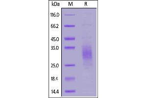 SDS-PAGE (SDS) image for Triggering Receptor Expressed On Myeloid Cells 2 (TREM2) (AA 19-174) (Active) protein (His tag,AVI tag,Biotin) (ABIN6973295)