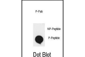 Dot blot analysis of anti-phospho-EphA2-p Phospho-specific Pab (ABIN650858 and ABIN2839809) on nitrocellulose membrane. (EPH Receptor A2 Antikörper  (pSer897))