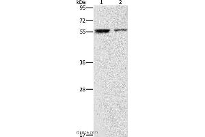 Western blot analysis of Jurkat and 293T cell, using ARHGAP15 Polyclonal Antibody at dilution of 1:500 (ARHGAP15 Antikörper)