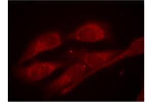 Image no. 3 for anti-SHC (Src Homology 2 Domain Containing) Transforming Protein 1 (SHC1) (pTyr427) antibody (ABIN197086) (SHC1 Antikörper  (pTyr427))