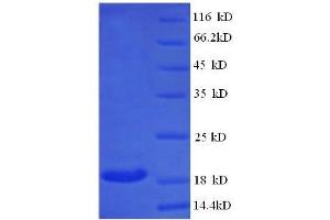 SDS-PAGE (SDS) image for Butyrylcholinesterase (BCHE) (AA 1-141), (full length) protein (His tag) (ABIN7478932)