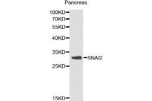 Western Blotting (WB) image for anti-Snail Family Zinc Finger 2 (SNAI2) (AA 89-268) antibody (ABIN6214866) (SLUG Antikörper  (AA 89-268))