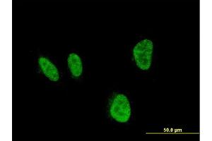 Immunofluorescence of monoclonal antibody to HOXA5 on HeLa cell. (HOXA5 Antikörper  (AA 171-270))
