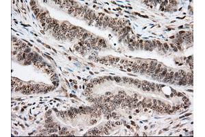 Immunohistochemical staining of paraffin-embedded Human pancreas tissue using anti-USP5 mouse monoclonal antibody. (USP5 Antikörper)