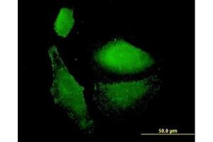 Image no. 3 for anti-Vesicle-Associated Membrane Protein 1 (Synaptobrevin 1) (VAMP1) (AA 28-97) antibody (ABIN598952) (VAMP1 Antikörper  (AA 28-97))