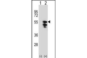 Western blot analysis of TUFM (arrow) using rabbit polyclonal TUFM Antibody (N-term) (ABIN389459 and ABIN2839526).