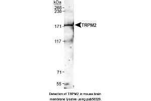 Image no. 1 for anti-Transient Receptor Potential Cation Channel, Subfamily M, Member 2 (TRPM2) (AA 1200-1300) antibody (ABIN363638) (TRPM2 Antikörper  (AA 1200-1300))