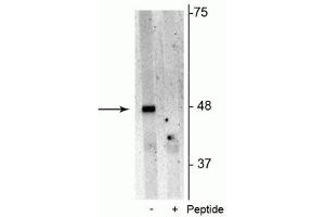 Western blot of Jurkat cell lysate showing specific immunolabeling of the ~48 kDa p62 phosphorylated at Ser28 in the first lane (-). (SQSTM1 Antikörper  (pSer28))