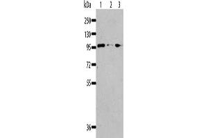 Gel: 8 % SDS-PAGE, Lysate: 40 μg, Lane 1-3: Jurkat cells, 293T cells, K562 cells, Primary antibody: ABIN7128323(AKAP8L Antibody) at dilution 1/117, Secondary antibody: Goat anti rabbit IgG at 1/8000 dilution, Exposure time: 30 seconds (AKAP8L Antikörper)