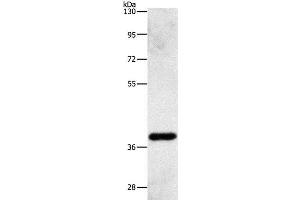 Western Blot analysis of Human fetal liver tissue using AMPK gamma1 Polyclonal Antibody at dilution of 1:500 (PRKAG1 Antikörper)