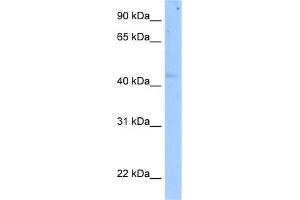 WB Suggested Anti-SETD7 Antibody Titration:  5. (SETD7 Antikörper  (C-Term))