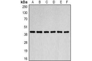 Western blot analysis of Beta-actin expression in Jurkat (A), MCF7 (B), NIH3T3 (C), mouse brain (D), rat brain (E), COS7 (F) whole cell lysates. (beta Actin Antikörper)