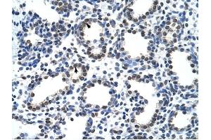 CARS antibody was used for immunohistochemistry at a concentration of 4-8 ug/ml to stain Alveolar cells (arrows) in Human Lung. (CARS Antikörper  (N-Term))
