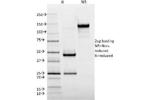 SDS-PAGE Analysis Purified HLA-DR Mouse Monoclonal Antibody (TAL 1B5). (HLA-DR Antikörper)