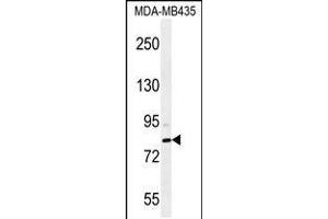 Western blot analysis in MDA-MB435 cell line lysates (35ug/lane). (SMYD4 Antikörper  (C-Term))