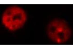 ABIN6267316 staining MOLT by IF/ICC. (Retinoblastoma 1 Antikörper  (pSer795))