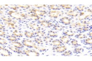 Immunohistochemistry (IHC) image for anti-Tenascin C (TNC) (AA 175-342) antibody (ABIN7439258)