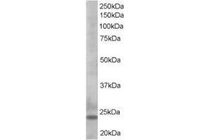 Image no. 1 for anti-BCL2-Like 11 (Apoptosis Facilitator) (BCL2L11) (C-Term) antibody (ABIN374444) (BIM Antikörper  (C-Term))