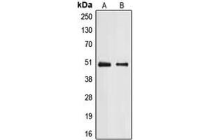 Western blot analysis of E2F2 expression in A431 (A), Jurkat (B) whole cell lysates. (E2F2 Antikörper  (Center))