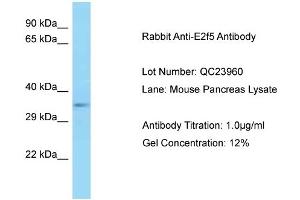 Host: Rabbit Target Name: E2f5 Sample Type: Mouse Pancreas Antibody Dilution: 1. (E2F5 Antikörper  (C-Term))