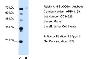 WB Suggested Anti-SLCO6A1  Antibody Titration: 1.