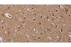 Immunohistochemistry of paraffin-embedded Human brain using MCTS1 Polyclonal Antibody at dilution of 1:60 (MCTS1 Antikörper)