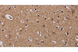 Immunohistochemistry of paraffin-embedded Human brain using MCTS1 Polyclonal Antibody at dilution of 1:60