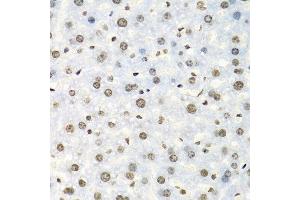 Immunohistochemistry of paraffin-embedded mouse liver using IGF2BP2 antibody at dilution of 1:100 (40x lens). (IGF2BP2 Antikörper)
