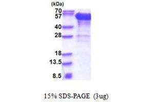 SDS-PAGE (SDS) image for Dynactin 2 (p50) (DCTN2) (AA 1-401) protein (His tag) (ABIN5853385)