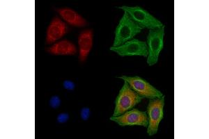 ABIN7093757 and ABIN7097791 staining Hela cells by IF/ICC.