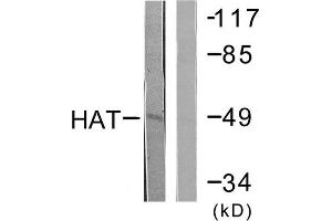Western Blotting (WB) image for anti-Histone Acetyltransferase (HAT) (C-Term) antibody (ABIN1848824) (HAT Antikörper  (C-Term))